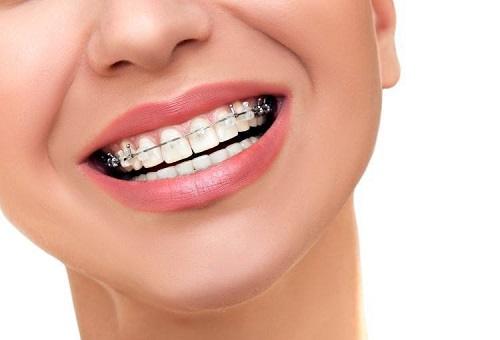 الصحة نولي تقويم الأسنان والفكين جل الاهتمام