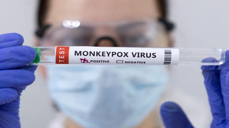 بريطانيا اللقاح المضاد لجدري القردة فعال بنسبة 78
